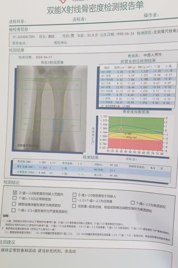 雙能X射線骨密度儀：準(zhǔn)確測(cè)量骨密度，助力骨質(zhì)疏松防治，守護(hù)骨骼健康